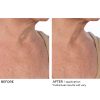 Hydro-screen intense hydration face & body soufflé - Afbeelding 9