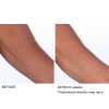 Crepe inhibitor triple action body butter - Afbeelding 6