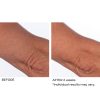 Crepe inhibitor triple action body butter - Afbeelding 4