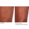 Crepe inhibitor triple action body butter - Afbeelding 11
