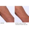 Crepe inhibitor triple action body butter - Afbeelding 8
