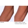 Crepe inhibitor triple action body butter - Afbeelding 9