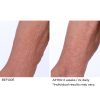 Crepe inhibitor triple action body butter - Afbeelding 10