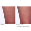 Crepe inhibitor triple action body butter - Afbeelding 12
