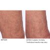 Crepe inhibitor triple action body butter - Afbeelding 7