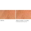 Deco-lift neck firming & lifting complex serum – Image 8