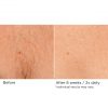 Deco-lift neck firming & lifting complex serum – Image 10