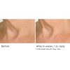 Deco-lift neck firming & lifting complex serum – Image 13
