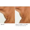Deco-lift neck firming & lifting complex serum – Image 4