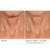 Deco-lift neck firming & lifting complex serum – Image 6