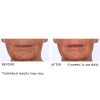 Dermaflect smart day cream 30ml - Afbeelding 10