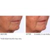 Dermaflect smart day cream 30ml - Afbeelding 11