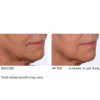 Dermaflect smart day cream 30ml - Afbeelding 4