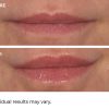 Hydro-screen for lips watermelon - Afbeelding 3