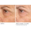 Peri-orbital eye complex - Afbeelding 8