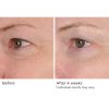 Peri-orbital eye complex - Afbeelding 6