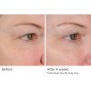 Peri-orbital eye complex - Afbeelding 5