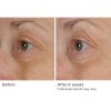 Peri-orbital eye complex - Afbeelding 4