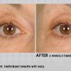 Under eye cream – Image 5