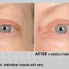 Under eye cream – Image 6