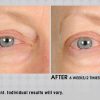 Under eye cream – Image 4