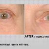 Under eye cream – Image 3
