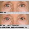 Under eye cream – Image 2