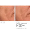 3HA Micro-Needle Wrinkle Strips - Afbeelding 11