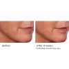 Pure Hydration Rejuvenating Night Cream - Afbeelding 11